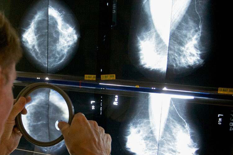 When should you get a mammogram?